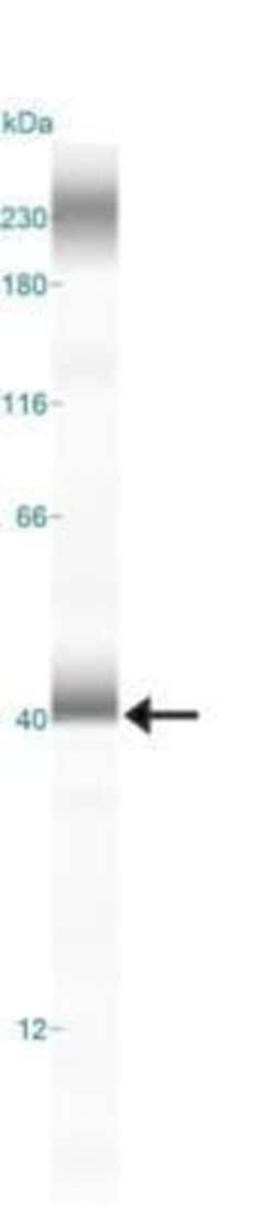 LAMP-2/CD107b Antibody (H4B4) - Azide and BSA Free, Novus Biologicals 0.1